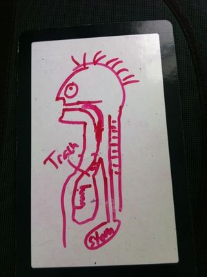 A line drawing in red marker on a dry erase board with a human profile showing the oropharynx, and how the lungs and stomach are positioned relative to the tracheotomy tube.